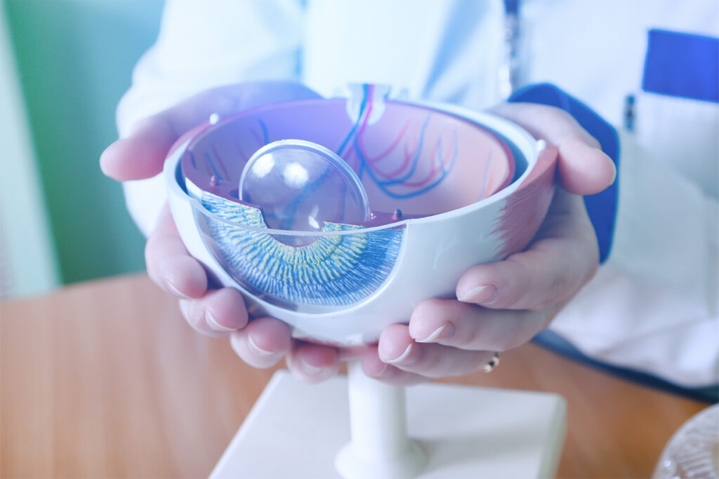 Cataract Lens Price List
