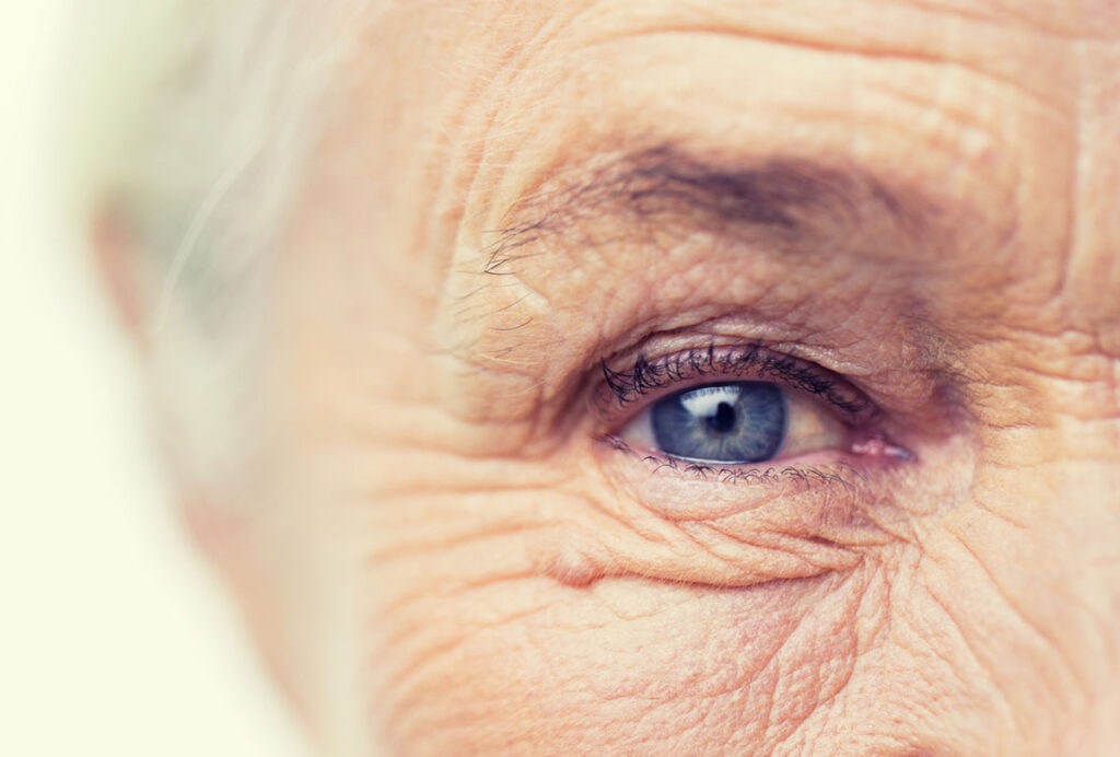 Cataract Surgery Cost