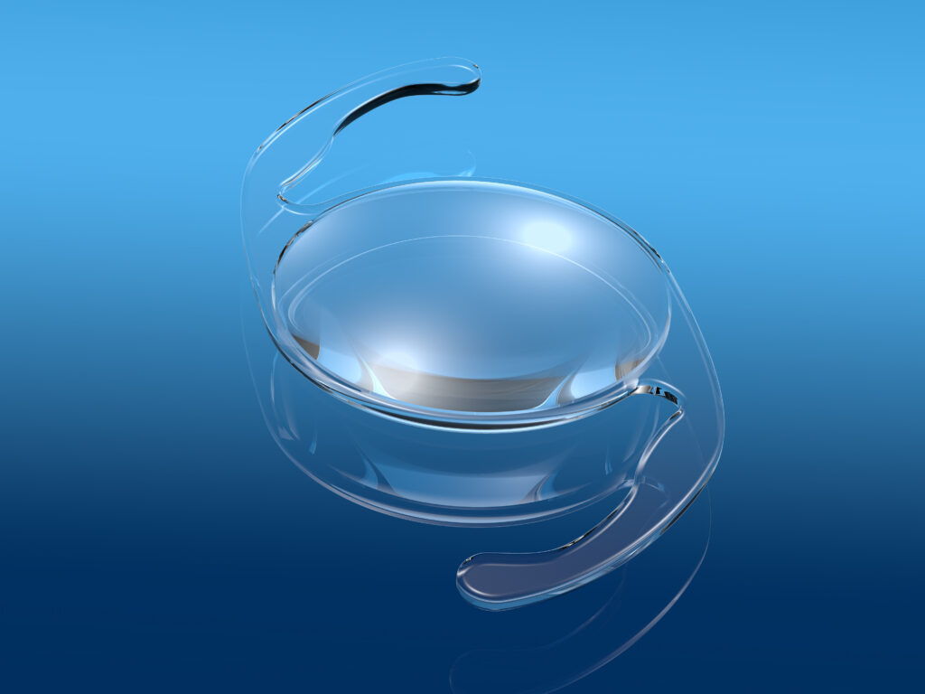 Cataract Lens Price List