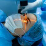 Sorting Through the Cataract Lens Price List: Which Option Is Right for You?